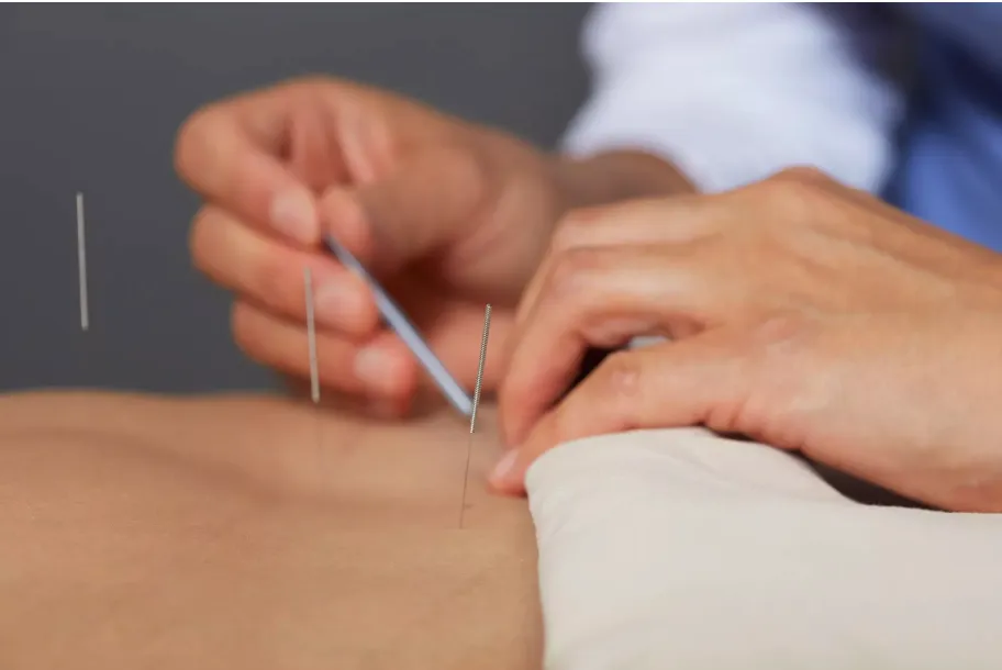 Holistic Acupuncture at Sesto Senso, holistic wellness centre in Limassol