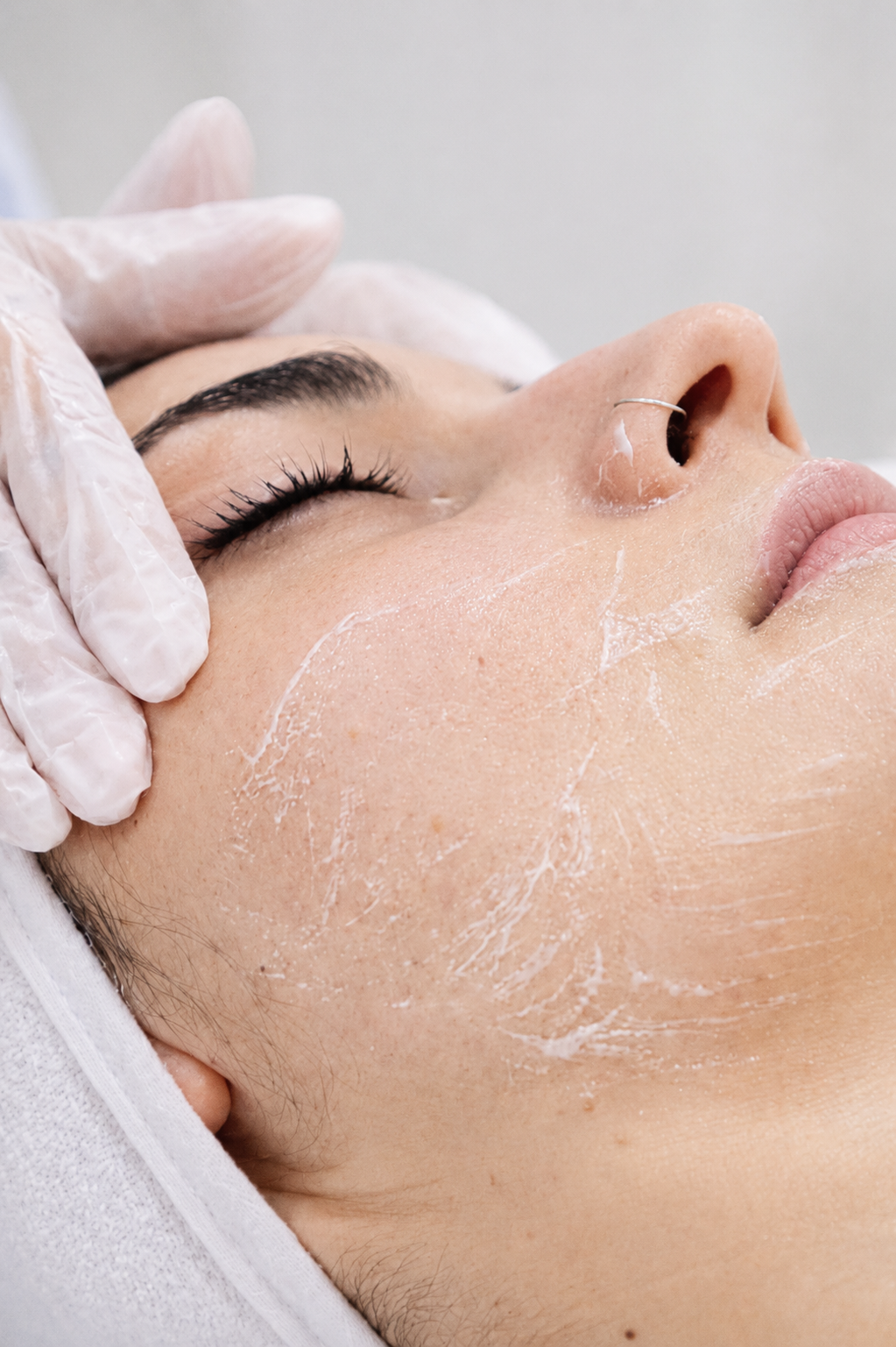 Non-Surgical Thread Lift at Sesto Senso, holistic wellness centre in Limassol